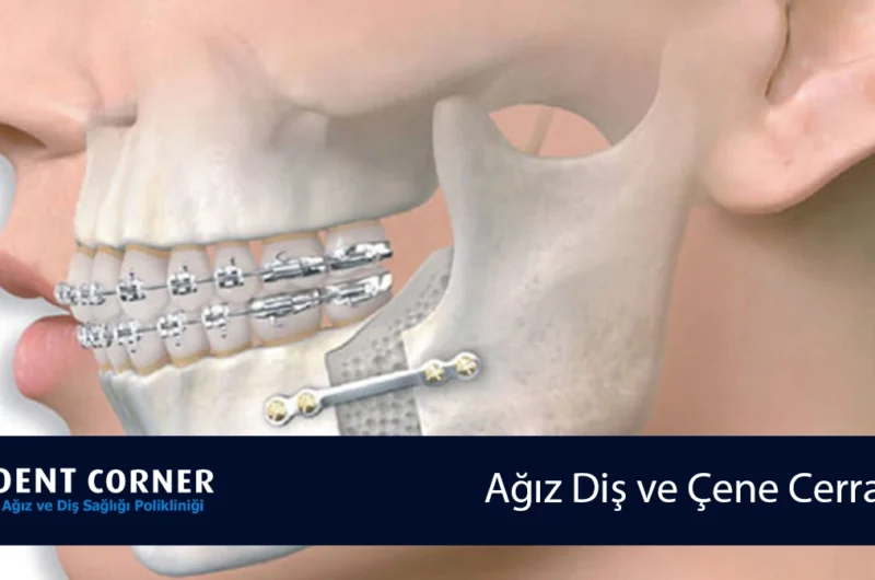 Ağız Diş ve Çene Cerrahisi: Ağız ve Yüz Sağlığınız İçin Hayati Bir Alan
