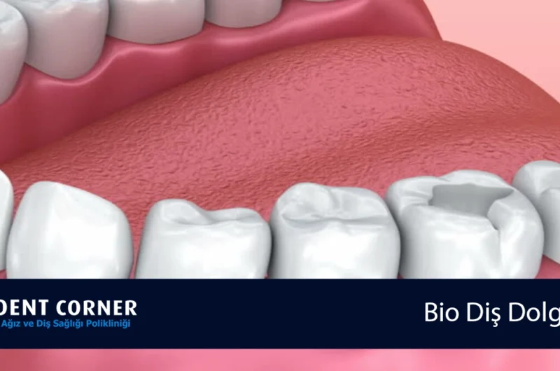 Bio Diş Dolgusu Ne Demektir?
