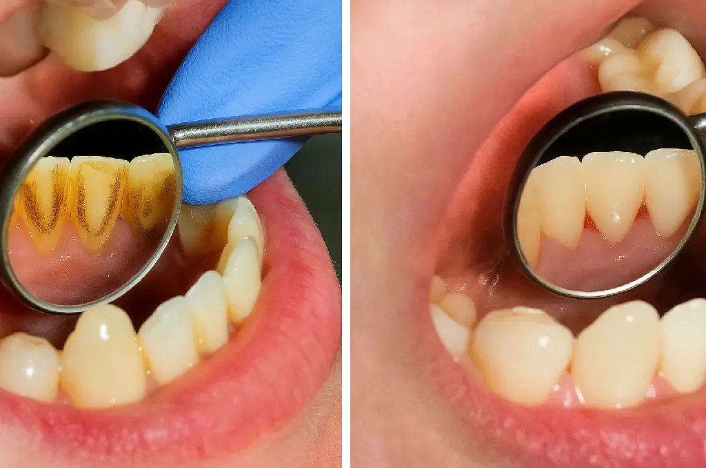 Periodontoloji
