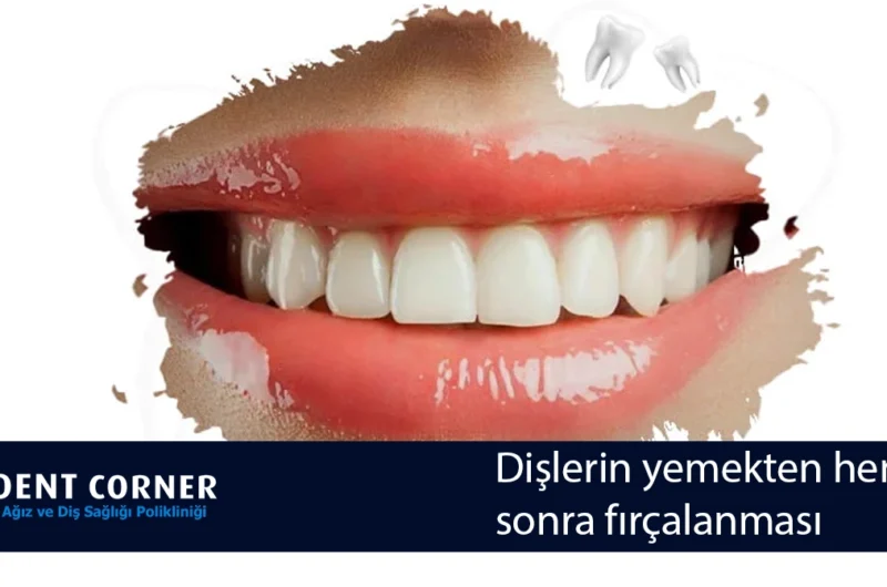 Dişlerin yemekten hemen sonra fırçalanması, Diş Sert Dokularında Aşınmaya Neden Olur
