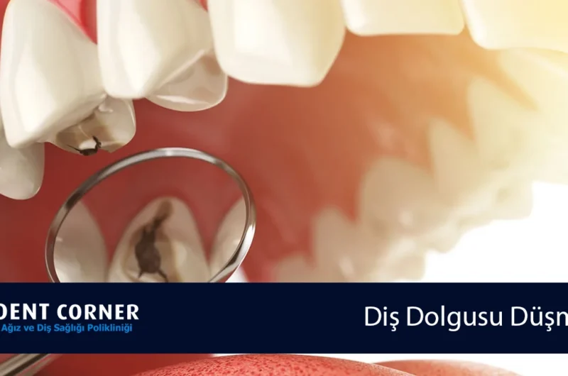 DİŞ DOLGUSU DÜŞMESİ SONUCU OLUŞAN YOĞUN AĞRI
